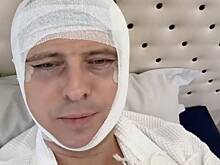 Шаляпин показал забинтованное лицо в синяках из больницы